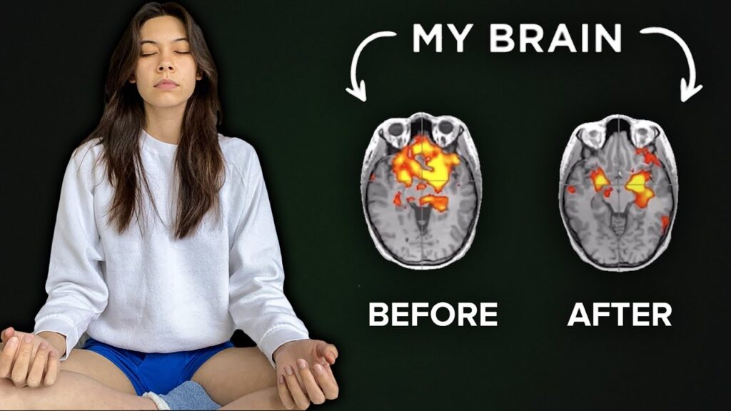 How Mindfulness Can Transform Your Brain